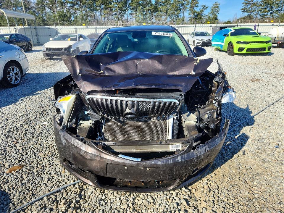 76991605 :رقم المزاد ، 1G4PP5SK5D4170872 vin ، 2013 Buick Verano مزاد بيع