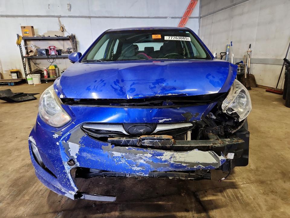 Aukcja sprzedaży 2013 Hyundai Accent, vin: KMHCU5AE3DU084978, numer aukcji: 77763085