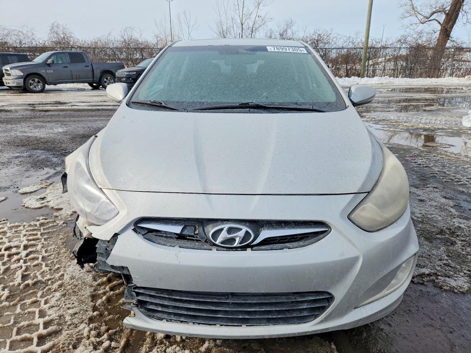 78997305 :رقم المزاد ، KMHCU5AE4EU155963 vin ، 2014 Hyundai Accent مزاد بيع