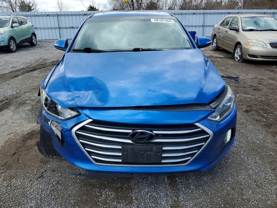 Aukcja sprzedaży 2017 Hyundai Elantra Gls 4dr, vin: KMHD84LF2HU249479, numer aukcji: 48167466