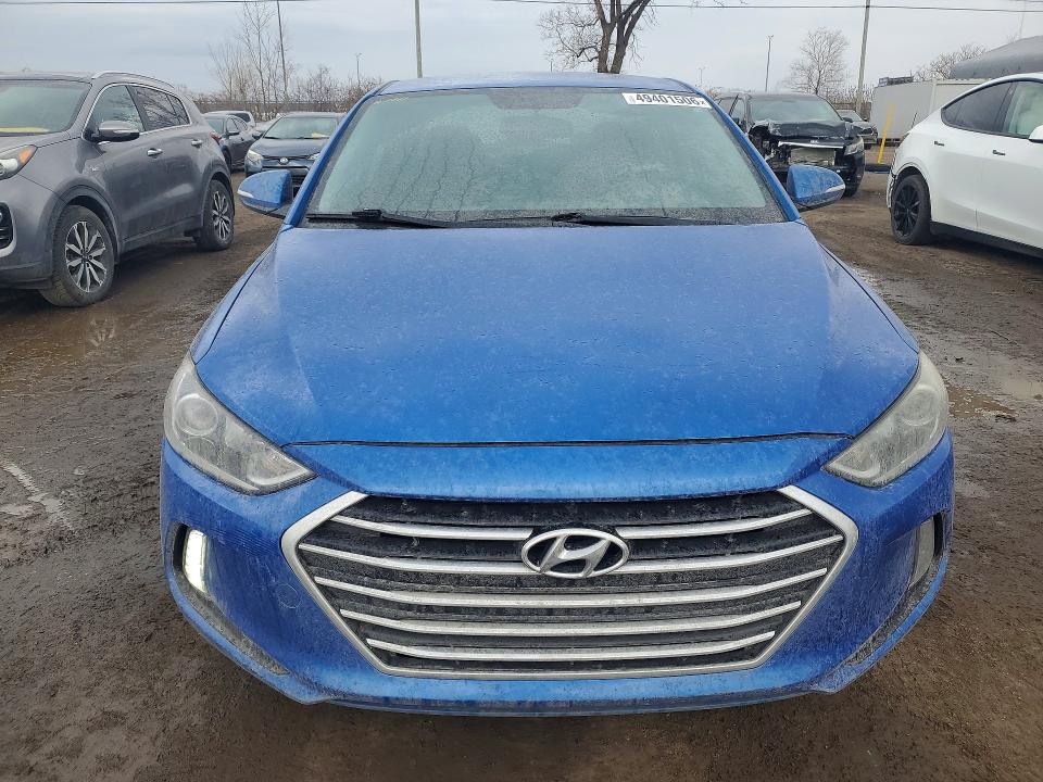 49401506 :رقم المزاد ، KMHD84LF9HU222313 vin ، 2017 Hyundai Elantra مزاد بيع