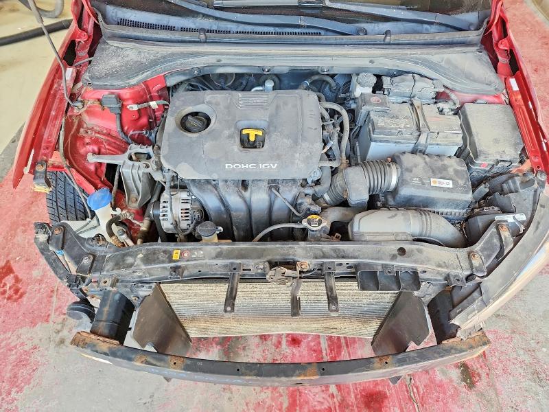 Aukcja sprzedaży 2017 Hyundai Elantra, vin: KMHD84LF4HU159380, numer aukcji: 55934826