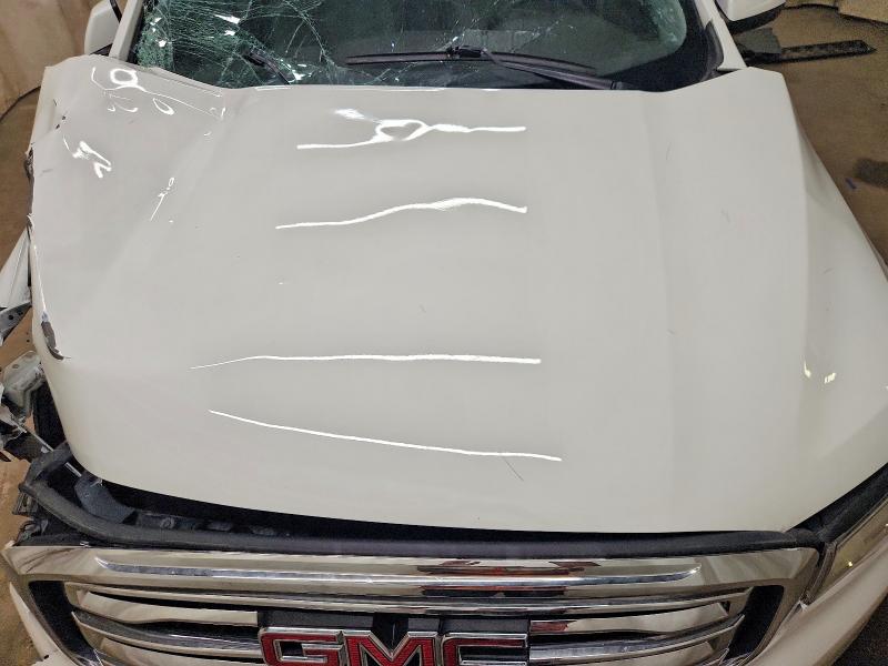 56357676 :رقم المزاد ، 1GKKNMLS2HZ186120 vin ، 2017 Gmc Acadia مزاد بيع