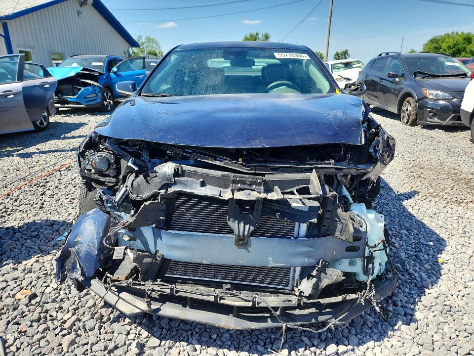 Продаж на аукціоні авто 2018 Chevrolet Malibu, vin: 1G1ZE5SX5JF251345, номер лоту: 55718406