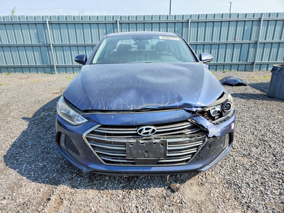 62062276 :رقم المزاد ، KMHD84LF1JU480802 vin ، 2018 Hyundai Elantra مزاد بيع