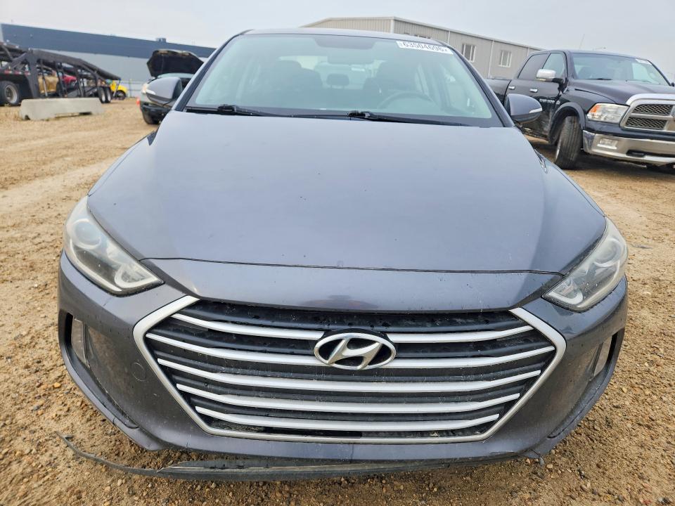 63504696 :رقم المزاد ، KMHD84LF1JU552582 vin ، 2018 Hyundai Elantra مزاد بيع